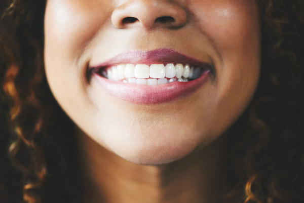 Close up of a beautiful woman smiling after getting dental implants at Singing River Dentistry in Tuscumbia, AL Close up of a beautiful woman smiling after getting dental implants at Singing River Dentistry in Tuscumbia, AL