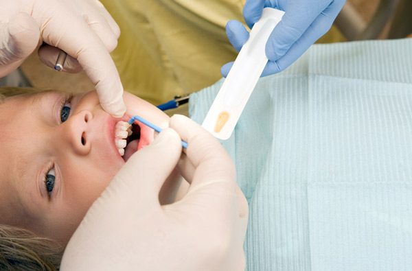 Young boy receiving fluoride treatment at Singing River Dentistry in Florence, AL.